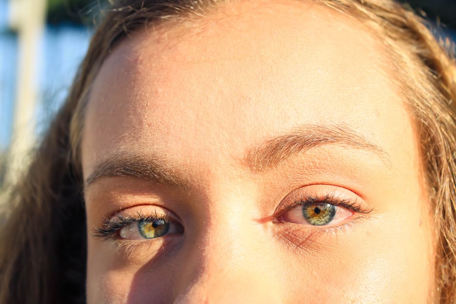 Prevent Forehead Wrinkles In Your 20S: Forehead Wrinkles in Your 20s: What Actually Works Prevent Forehead Wrinkles In Your 20S: Forehead Wrinkles in Your 20s: What Actually Works